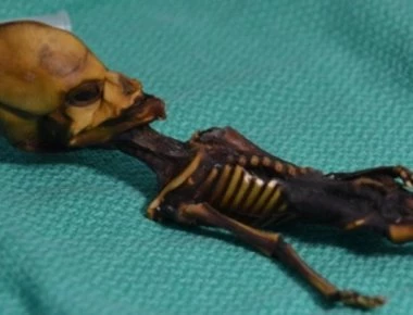 «Άτα»: Κορίτσι με πολλές και ασυνήθιστες γενετικές μεταλλάξεις o «εξωγήινος» της χιλιανής ερήμου;